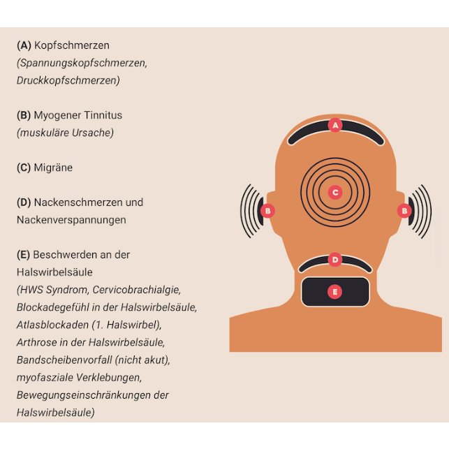 Grilletto del collo Dura